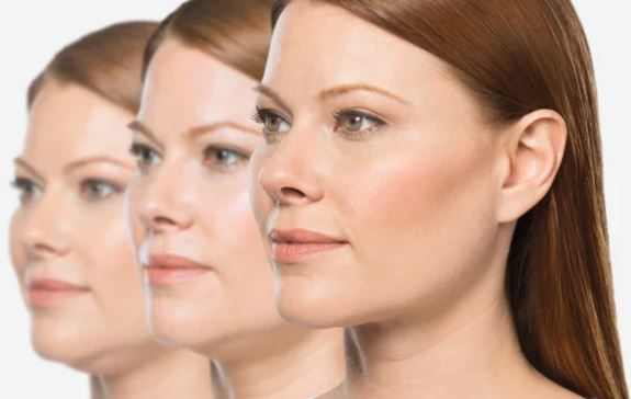Get rid of a double chin with Kybella at Hayes Valley Medical & Esthetics