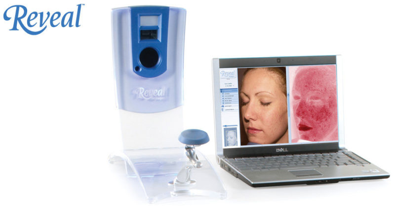 The Reveal Image Camera For Facial Analysis Hayes Valley Medical Esthetics