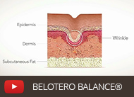 link to video-belotero-balance
