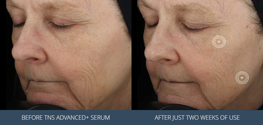 Serum Before and After