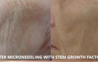 Stem Cell Growth Factors