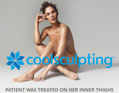 coolsculpting page header