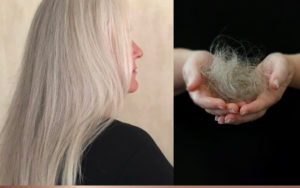 Hair Regrowth Treatment