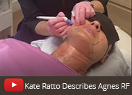 kate ratto RN agnes RF microneedling video