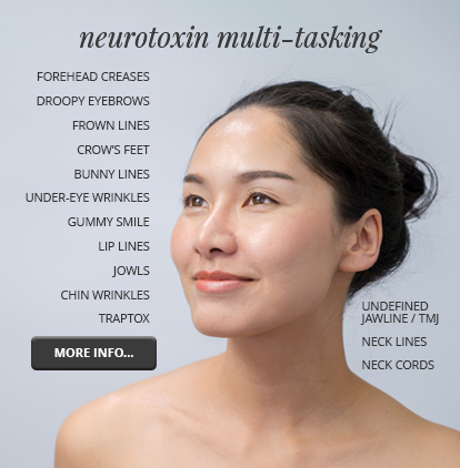 Neurotoxin Botox Dysport Off-label