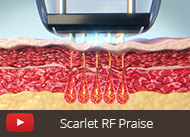 scarlet RF SRF video thumbnail